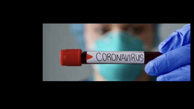 CORONAVIRS] EXAME.001