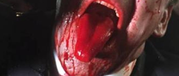 sangue