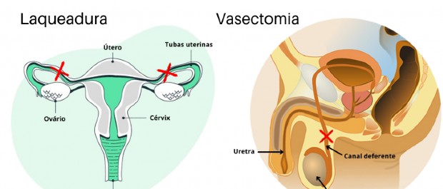 cirurgia